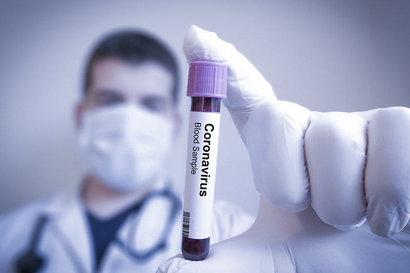 בדיקת דם נגיף הקורונה | צילום: Shutterstock